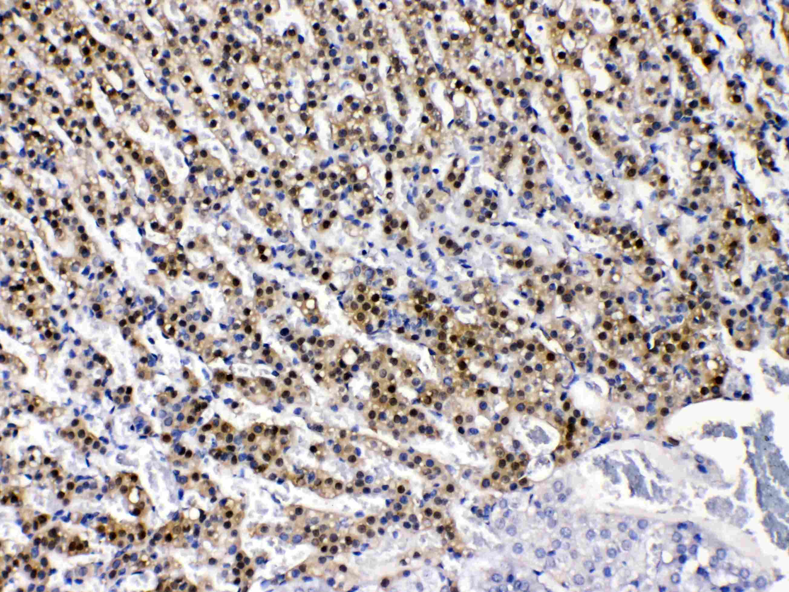 AKR1B1 / Aldose Reductase Antibody