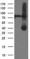 ADH2 / ADH1B Antibody (clone OTI4F12)