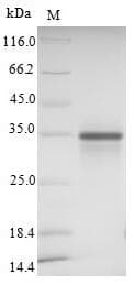 Human SIGLEC15 Protein (Recombinant 6His, N-terminus)