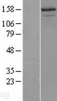 Human NCOA3 / SRC-3 / AIB1 Protein (Over-Expression Lysate Myc-DDK (Flag))