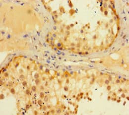 MEN1 / Menin Antibody