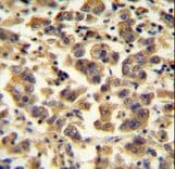 TTC39B Antibody (aa625-654)