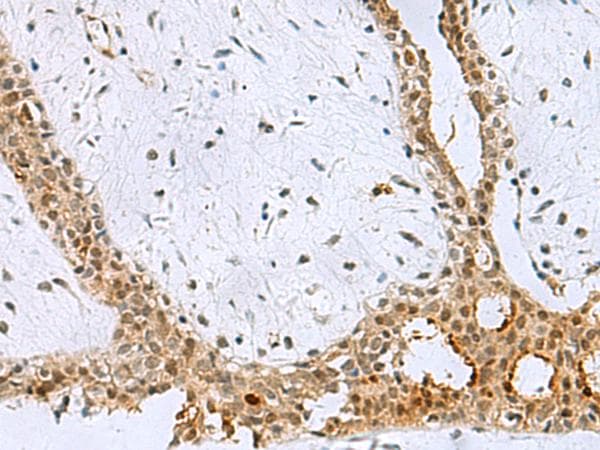 BCL7B Antibody
