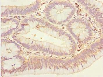 EYA3 Antibody