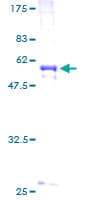 Human COL2A1 / Collagen II Alpha 1 Protein (Recombinant GST)