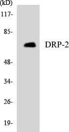 IHC-plus™ Polyclonal Rabbit anti-Human DPYSL2 / CRMP2 Antibody (aa461-510, IHC, WB)