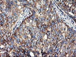 CLPP Antibody (clone OTI1F6, Carrier-free)
