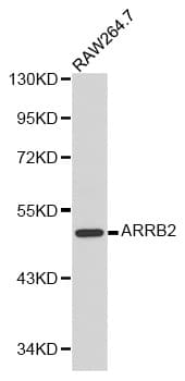 Polyclonal Rabbit anti-Human ARRB2 / Beta Arrestin 2 Antibody (IHC, IF, WB)