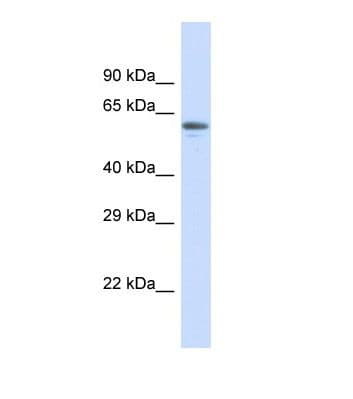 Polyclonal Rabbit anti-Human ZNF527 Antibody (aa21-70, WB)