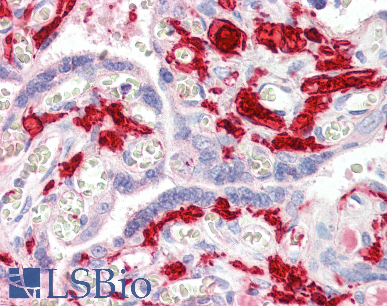 PathPlus™ Polyclonal Sheep anti-Human F13A1 / Factor XIIIa Antibody (IHC)