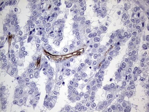 CDH4 / R Cadherin Antibody (aa170-428, clone OTI4F5, Carrier-free)