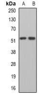 Polyclonal Rabbit anti-Human MPP1 Antibody (WB)