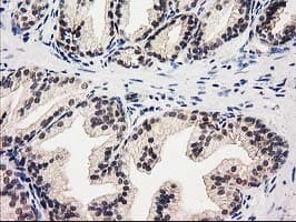 GSS / Glutathione Synthetase Antibody (clone OTI1B8)