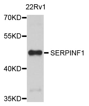 SERPINF1 / PEDF Antibody