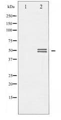GSK3 Alpha+Beta Antibody