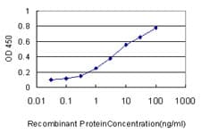 IHC-plus™ DUSP6 / MKP3 Antibody (clone 3G2)