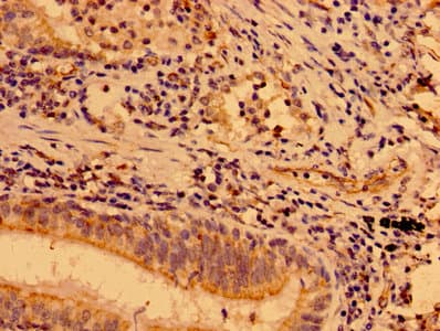 Polyclonal Rabbit anti-Human MAP3K9 / MLK1 Antibody (IHC, WB)