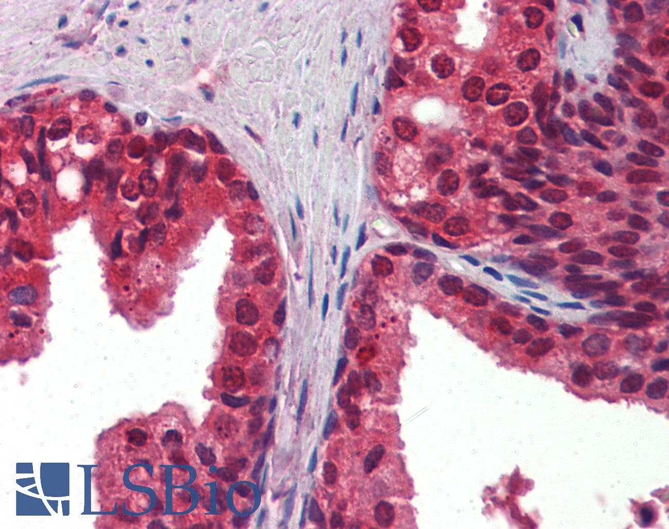 IHC-plus™ CANX / Calnexin Antibody (clone 3H4A7)
