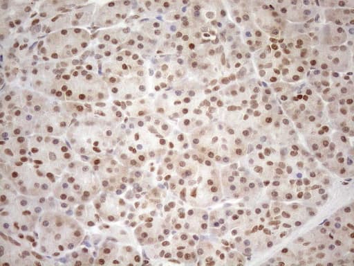 MGMT Antibody (clone OTI2E2)