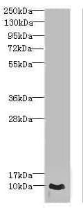 Polyclonal Rabbit anti-Human CRIP1 Antibody (IHC, WB)