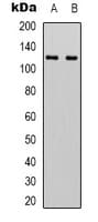Monoclonal Mouse anti-Human IDE Antibody (WB)