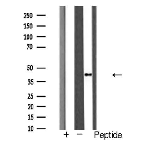 IHC-plus™ Polyclonal Rabbit anti-Human CTSD / Cathepsin D Antibody (IHC, IF, WB)