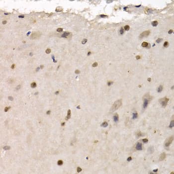 Polyclonal Rabbit anti-Human RAD1 Antibody (IHC, IF, WB)