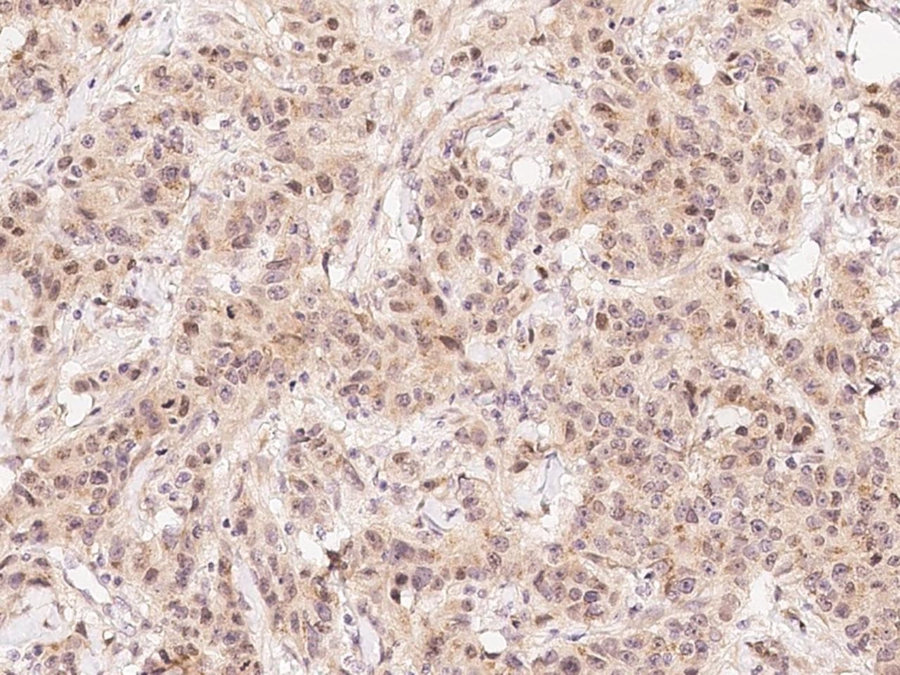 HIF1AN Antibody (Preservative Free)