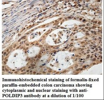 Polyclonal Rabbit anti-Human POLDIP3 / p46 Antibody (aa4-149, IHC, WB)