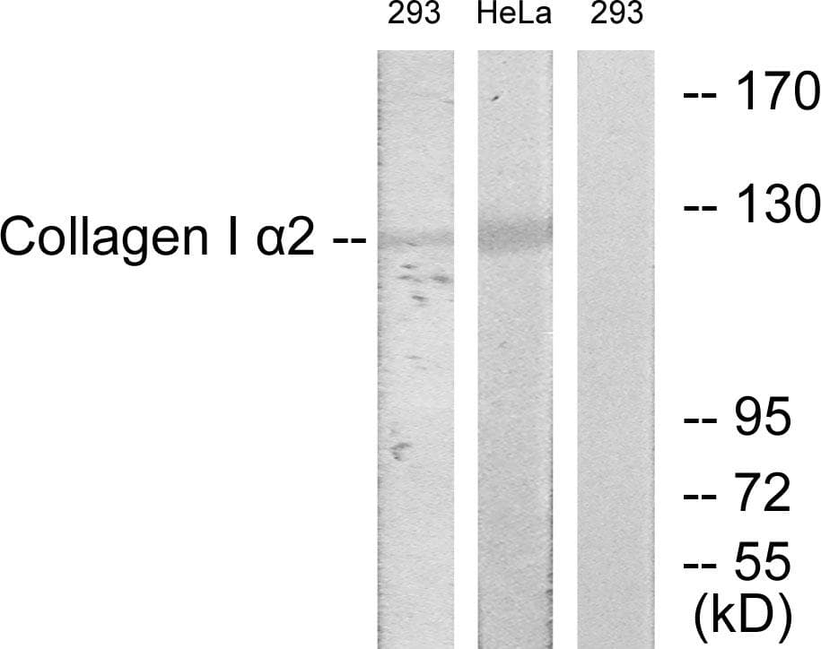COL1A2 / Collagen I Alpha 2 Antibody