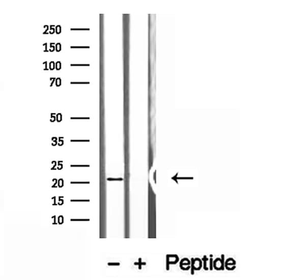 NUDT21 Antibody