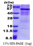 Human GPNMB / Osteoactivin Protein (Recombinant His)
