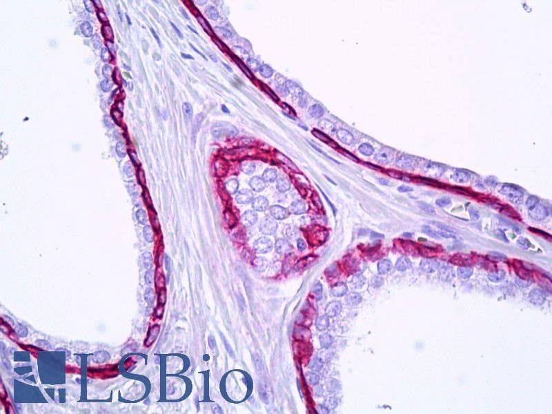 PathPlus™ KRT15 / CK15 / Cytokeratin 15 Antibody (aa1-50)
