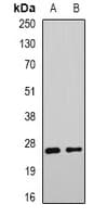 ERdj4 / DNAJB9 Antibody