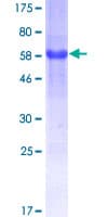 Human ATF6 Protein (Recombinant GST)