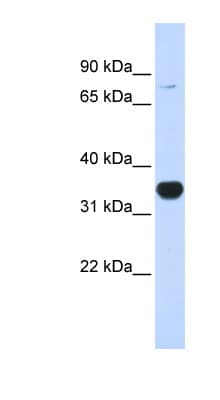 RHOT1 Antibody (aa180-229)