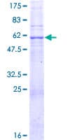 Human RNF148 Protein (Recombinant GST)