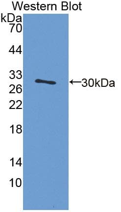 PIBF1 / PIBF Antibody (aa13-203, FITC)
