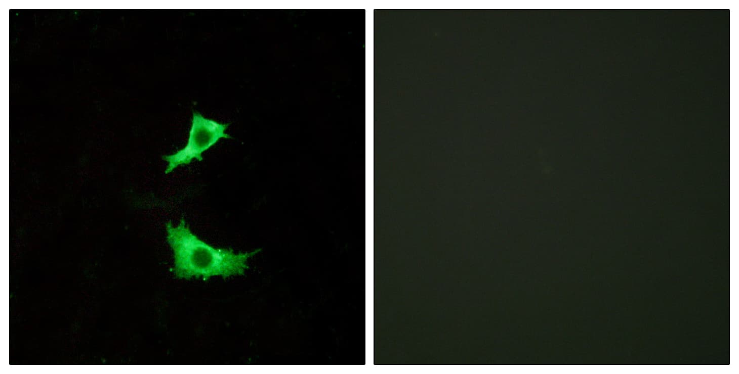 FFAR3 / GPR41 Antibody (aa11-60)