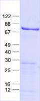 Human C21orf62 Protein (Recombinant His, N-Terminal)