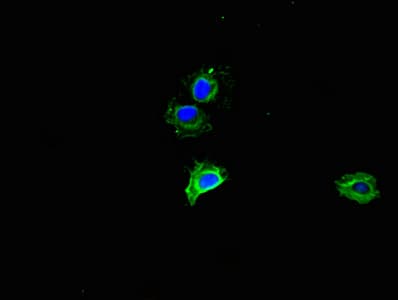 Polyclonal Rabbit anti-Human MMP2 Antibody
