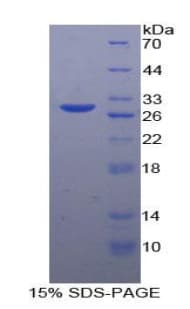 Human ARA55 / HIC-5 Protein (Recombinant)