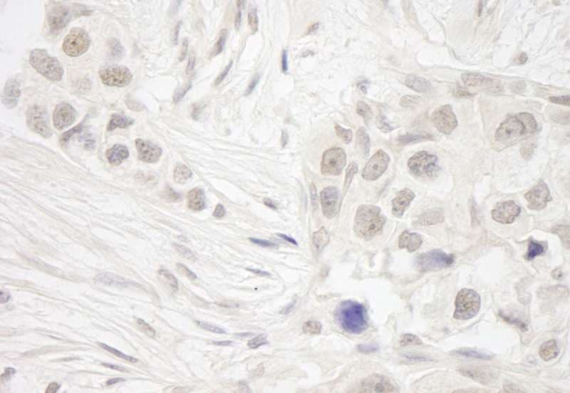 NSL1 Antibody (aa150-200)