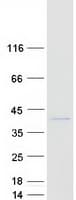 Human MOSC1 Protein (Recombinant Myc-DDK (Flag))