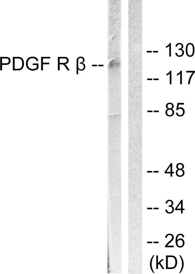 PDGFRB / PDGFR Beta Antibody (p1021)