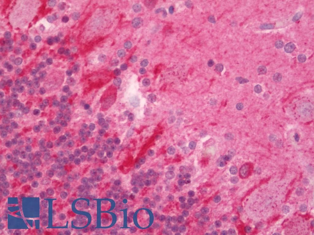 IHC-plus™ Polyclonal Rabbit anti-Human DUSP9 Antibody (aa140-184, IHC, IF, WB)