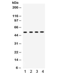 Polyclonal Rabbit anti-Human GJA3 / CX46 / Connexin 46 Antibody (WB)