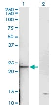 TNNI2 Antibody (clone 2D5)