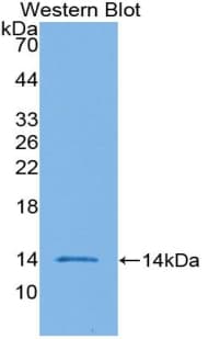 Procalcitonin Antibody (aa26-138)