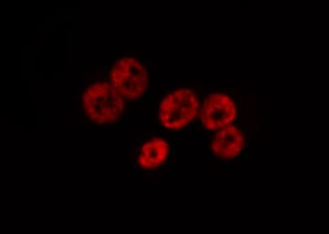 SMAD1 Antibody (phospho-Ser187)
